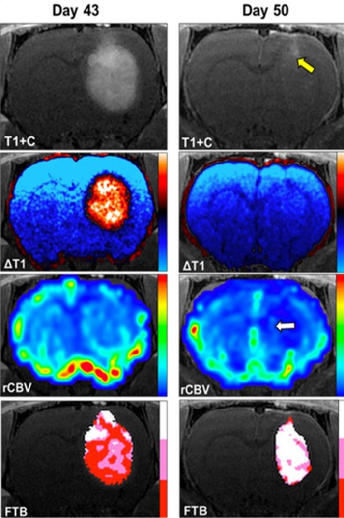 “欺骗”和摧毁癌细胞的创新疗法取得进展