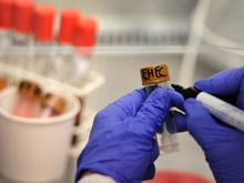 Bereits 31 gemeldete Ehec-Fälle: Behörde in Mecklenburg-Vorpommern geht von „Ausbruch“ aus