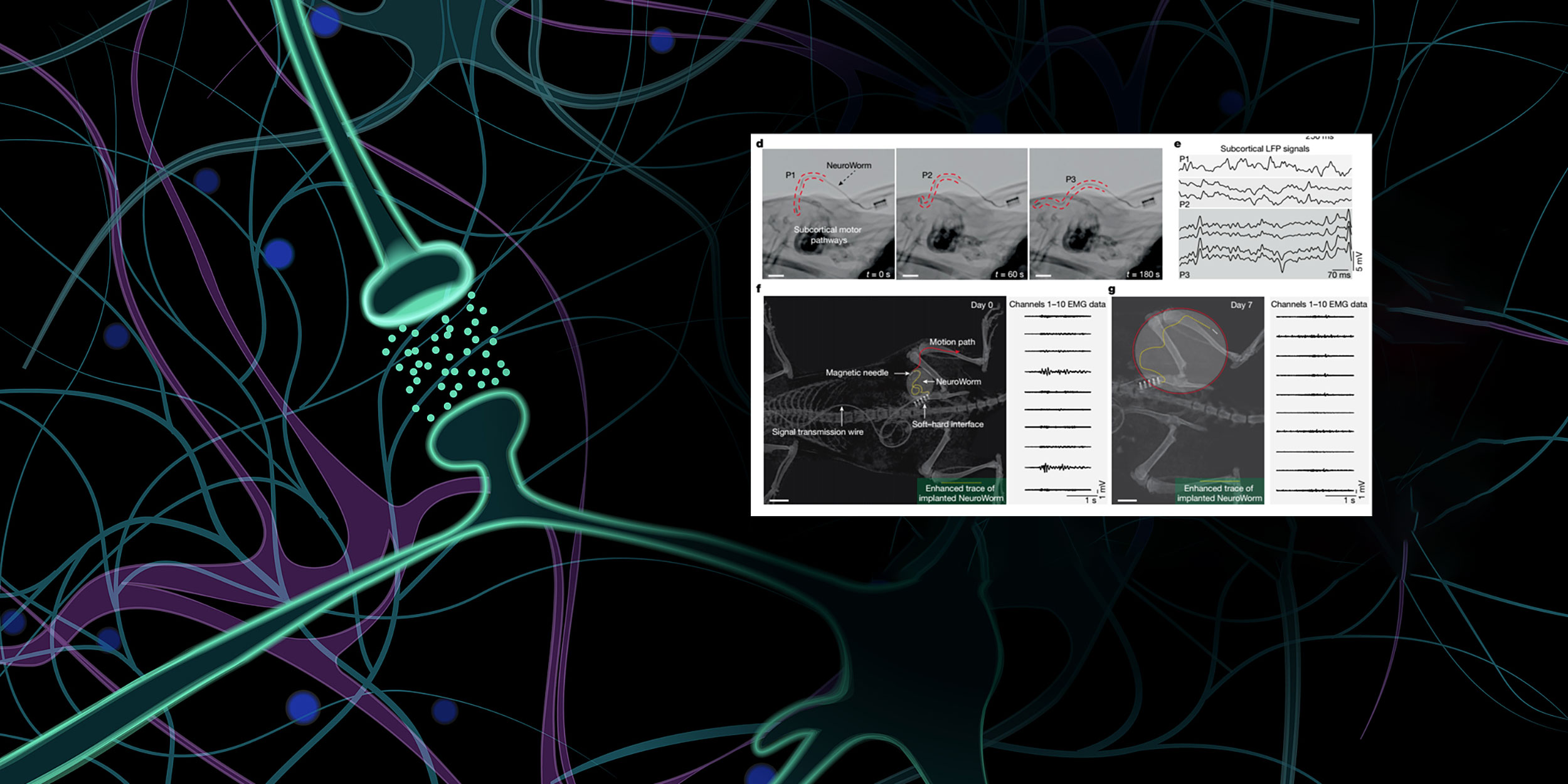 China’s NeuroWorm Inches Its Way Toward Brain Disorder Breakthroughs