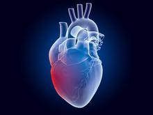 Bakterien als Ursache für Herzinfarkte?: Neue Hoffnung, Anfälle mit Antibiotika verhindern zu können