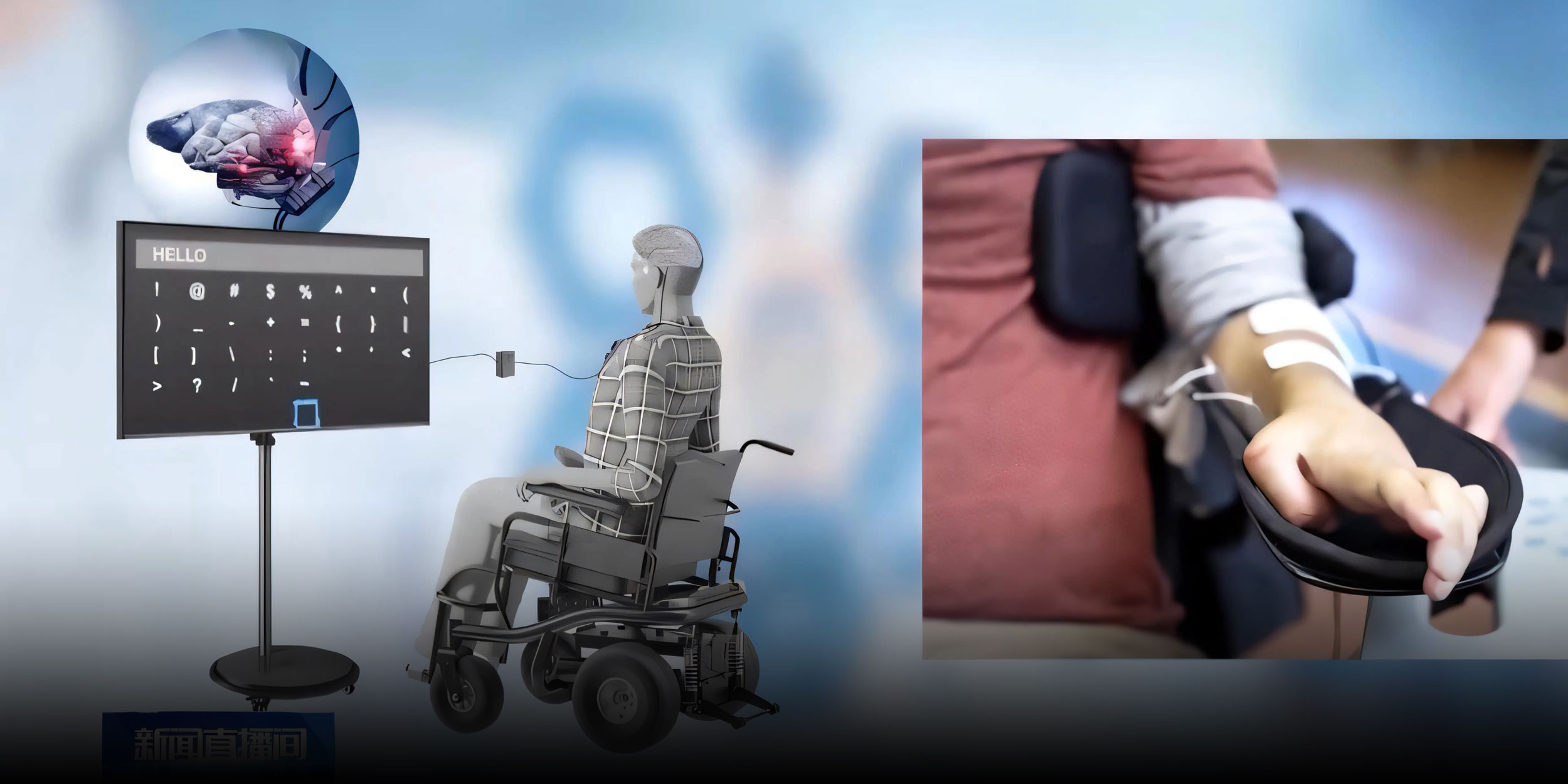 China Performs First Brain Implant Procedure Under State Pricing