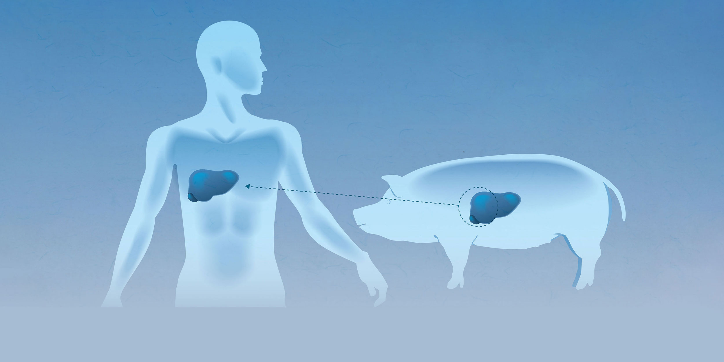 Chinese Scientists Save Patient Using Pig Liver Outside the Body